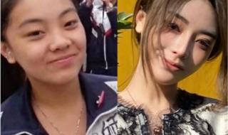 整容狂人的毁容日记