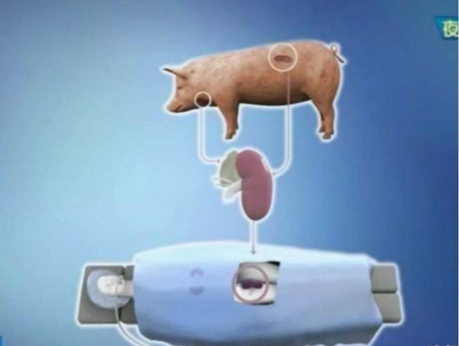 移植猪心脏后的基因污染（猪的心脏可以移植给人类吗有什么后遗症）