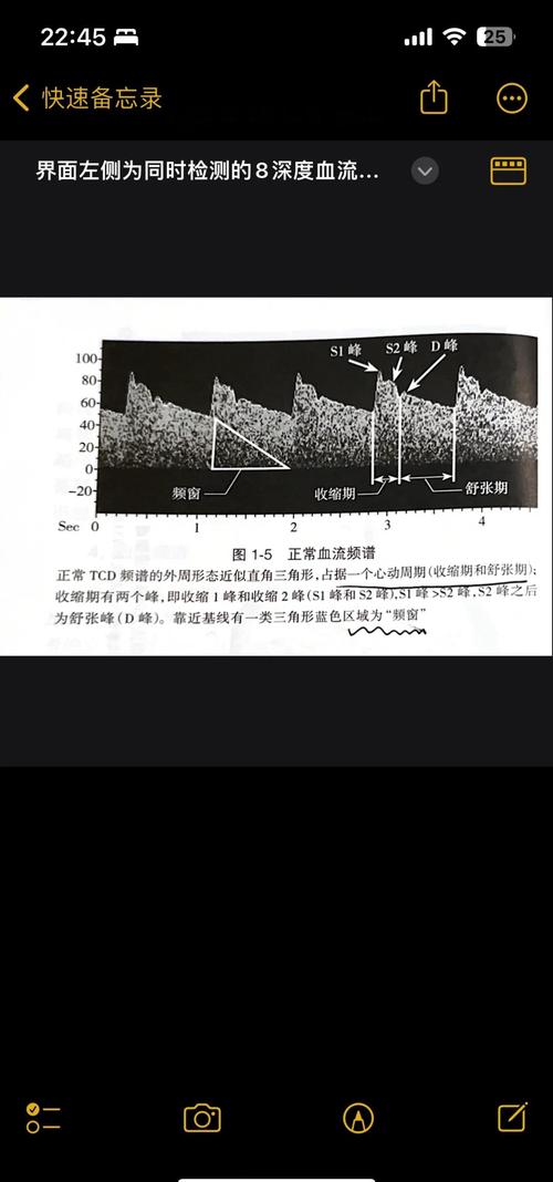 超声波唤醒昏迷患者原理（超声波dgs）