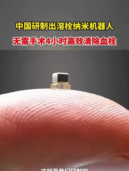 纳米机器人清除血栓实录（纳米机器人怎么才能出去血管）