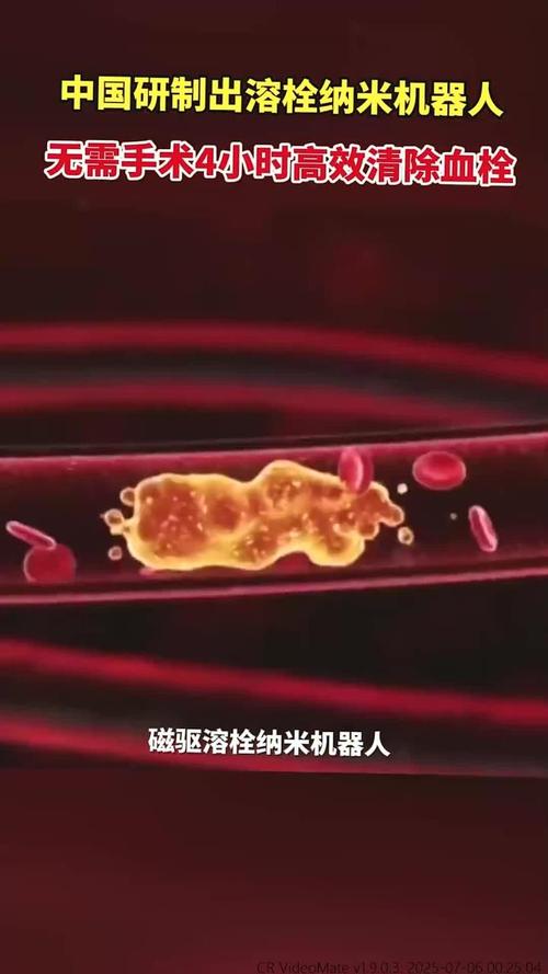 纳米机器人清除血栓实录（纳米机器人怎么才能出去血管）